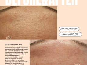 gelaatsverzorging skincare dermaplaning before and after skincare gelaatsverzorging